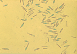 ウエルシュ菌による食中毒｜顕微鏡写真